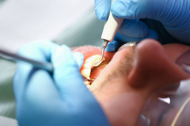 Best Emergency Broken Tooth Repair in Lawrence, KS