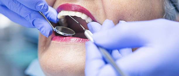 Best Emergency Wisdom Teeth Removal in Lawrence, KS